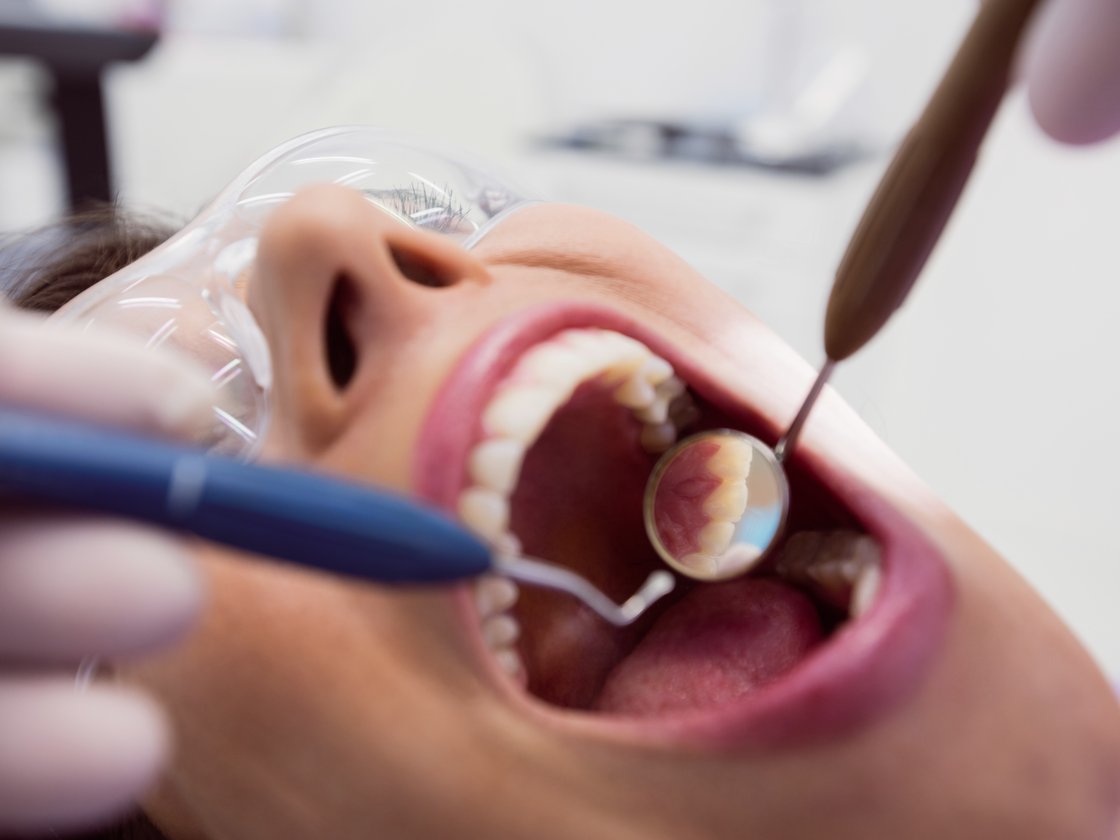 Clinical periodontal assessment
